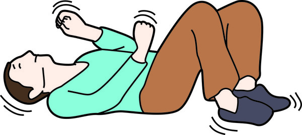 Épilepsie décodée : Guide complet sur les symptômes, les causes et les traitements innovants